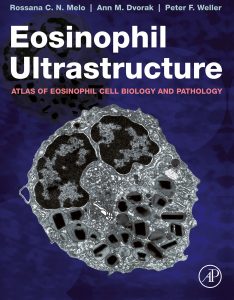 Eosinophil Ultrastructure: Atlas of Eosinophil Cell Biology and Pathology